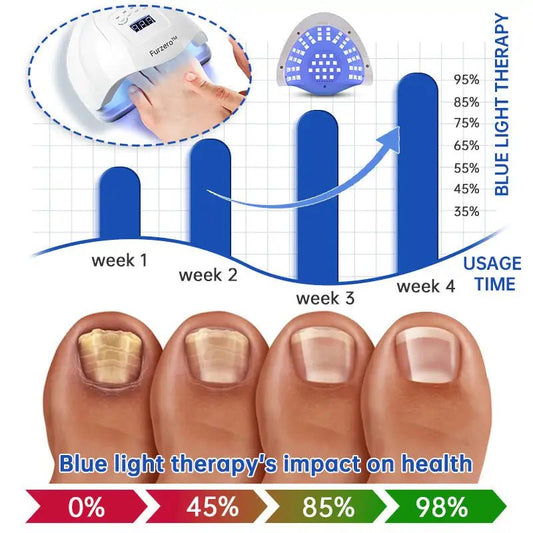 Fungus Laser Therapy Device - Eternal flavors