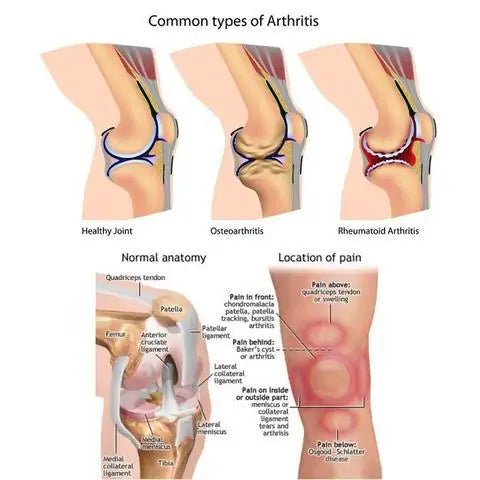 Joint Arthritis Patch - Eternal flavors